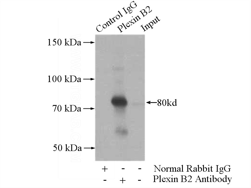 IP Result of anti-PLXNB2 (IP:Catalog No:113966, 4ug; Detection:Catalog No:113966 1:1000) with mouse liver tissue lysate 4000ug.