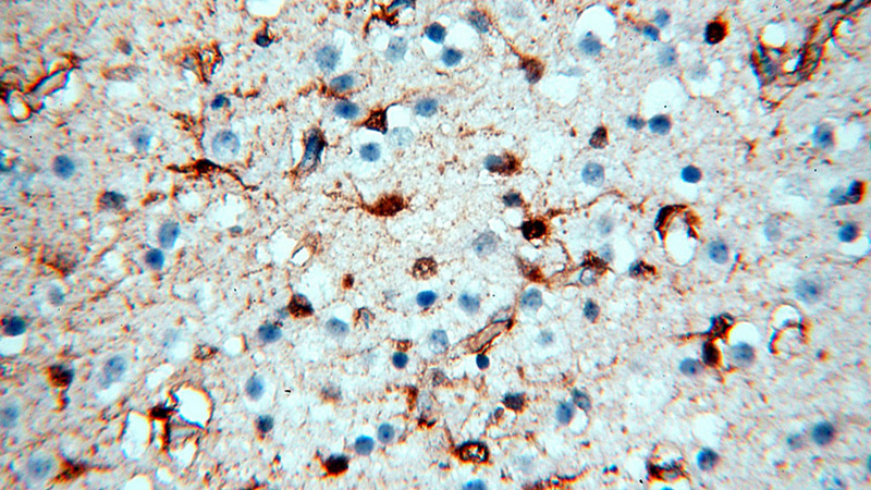 Immunohistochemical of paraffin-embedded human brain using Catalog No:112762(MT3 antibody) at dilution of 1:50 (under 40x lens)