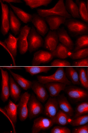 Immunofluorescence - PSMA5 Polyclonal Antibody 