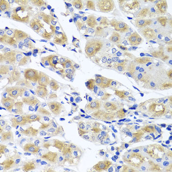 Immunohistochemistry - SPATA4 Polyclonal Antibody 