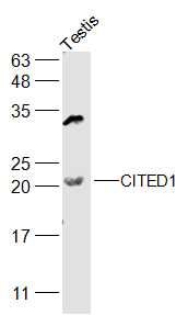 Fig2: Sample:; Testis (Mouse) Lysate at 40 ug; Primary: Anti-CITED1 at 1/2000 dilution; Secondary: IRDye800CW Goat Anti-Rabbit IgG at 1/20000 dilution; Predicted band size: 20 kD; Observed band size: 20 kD