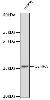 Western blot - CENPA Polyclonal Antibody 