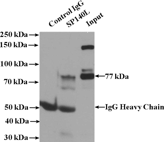 IP Result of anti-SP140L (IP:Catalog No:115524, 4ug; Detection:Catalog No:115524 1:500) with HeLa cells lysate 3200ug.