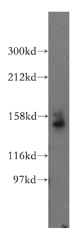 human heart tissue were subjected to SDS PAGE followed by western blot with Catalog No:115670(STAG1 antibody) at dilution of 1:500