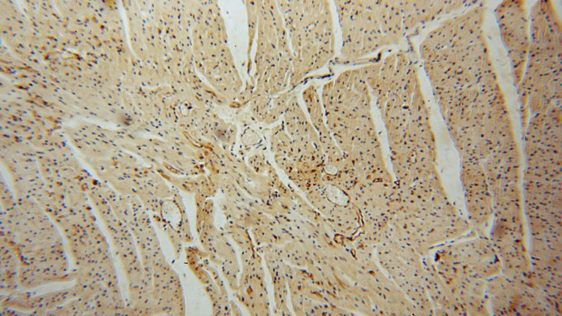 Immunohistochemical of paraffin-embedded human heart using Catalog No:116054(THBD antibody) at dilution of 1:50 (under 10x lens)