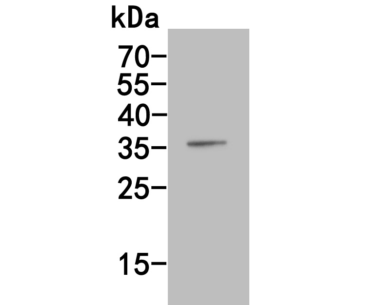 Fig2:; Western blot analysis of XRCC2 on human kidney tissue lysates. Proteins were transferred to a PVDF membrane and blocked with 5% BSA in PBS for 1 hour at room temperature. The primary antibody ( 1/500) was used in 5% BSA at room temperature for 2 hours. Goat Anti-Rabbit IgG - HRP Secondary Antibody (HA1001) at 1:5,000 dilution was used for 1 hour at room temperature.