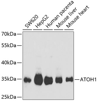 Western blot - ATOH1 Polyclonal Antibody 