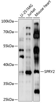 Western blot - SPRY2 Polyclonal Antibody 