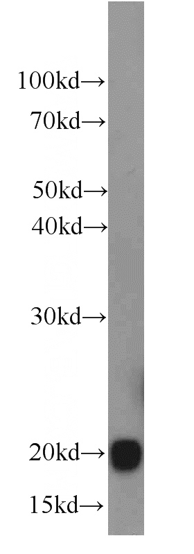 mouse kidney tissue were subjected to SDS PAGE followed by western blot with Catalog No:111149(GPX4 antibody) at dilution of 1:1000
