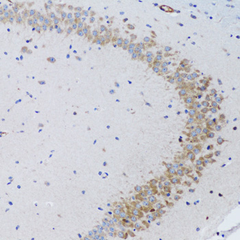 Immunohistochemistry - TNFSF12 Polyclonal Antibody 
