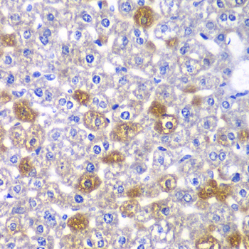 Immunohistochemistry - MYO1C Polyclonal Antibody 