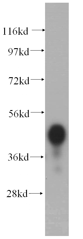human liver tissue were subjected to SDS PAGE followed by western blot with Catalog No:113760(PCYT2 antibody) at dilution of 1:500