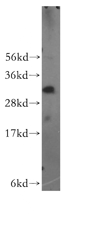 Jurkat cells were subjected to SDS PAGE followed by western blot with Catalog No:113254(NMRAL1 antibody) at dilution of 1:500