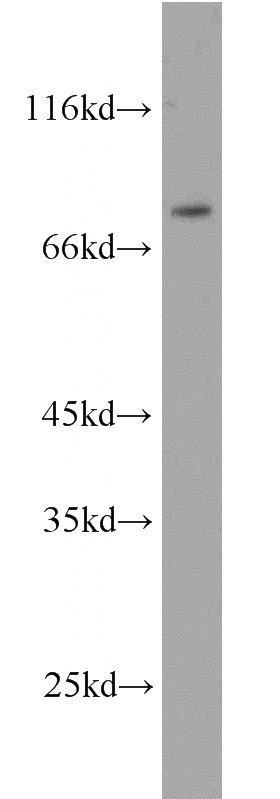 HeLa cells were subjected to SDS PAGE followed by western blot with Catalog No:110408(ERCC2 antibody) at dilution of 1:500