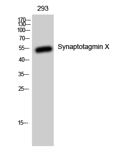 Fig1:; Western Blot analysis of 293 cells using Synaptotagmin X Polyclonal Antibody