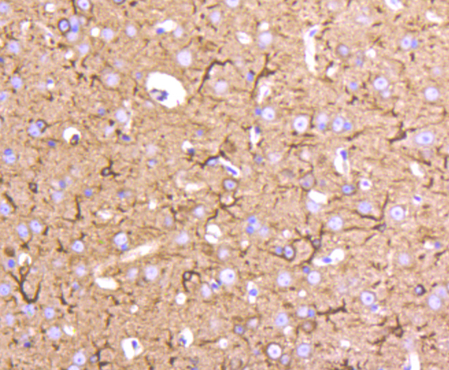 Immunohistochemistry - Tubulin Beta 2 Monoclonal Antibody 