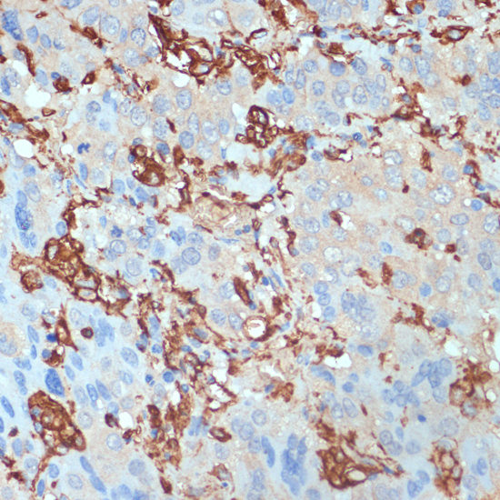 Immunohistochemistry - HLA-DRA Polyclonal Antibody 