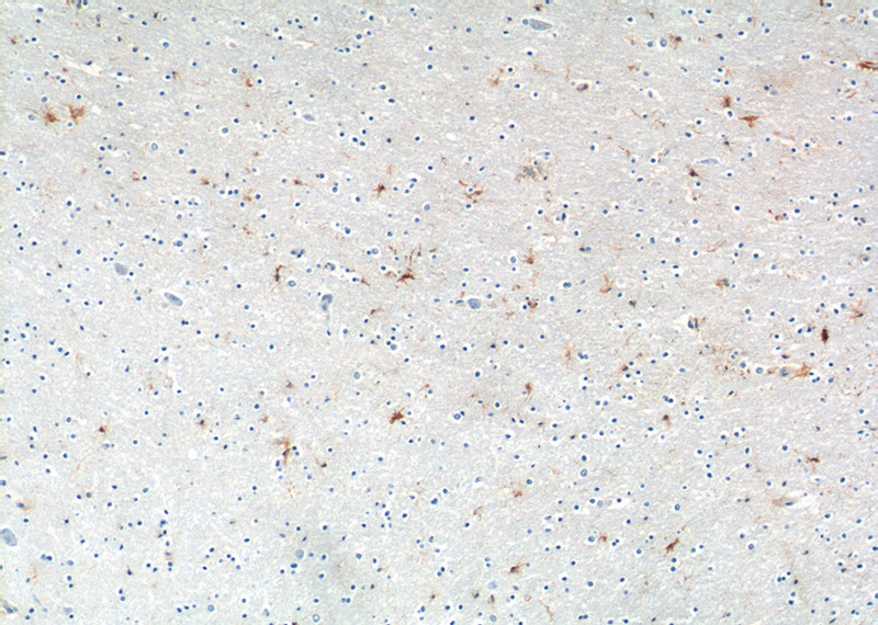 Immunohistochemistry of paraffin-embedded human brain tissue slide using Catalog No:112485(MAS1L Antibody) at dilution of 1:50 (under 10x lens)