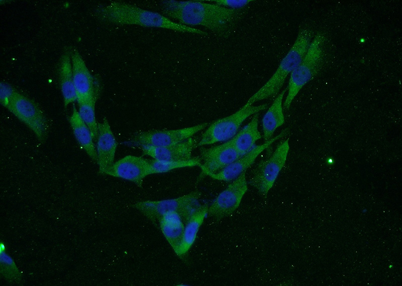 Immunofluorescent analysis of A375 cells using Catalog No:111348(C11orf73 Antibody) at dilution of 1:50 and Alexa Fluor 488-congugated AffiniPure Goat Anti-Rabbit IgG(H+L)