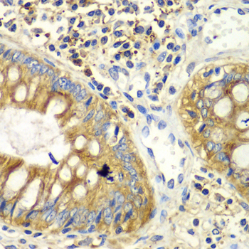 Immunohistochemistry - PICK1 Polyclonal Antibody 