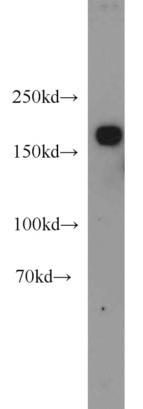 HeLa cells were subjected to SDS PAGE followed by western blot with Catalog No:111998(KIDINS220 antibody) at dilution of 1:1000