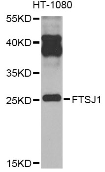 Western blot - FTSJ1 Polyclonal Antibody 