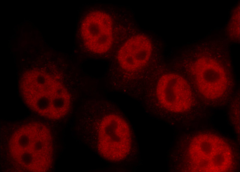 Immunofluorescent analysis of HepG2 cells using Catalog No:107354(IRF5 Antibody) at dilution of 1:50 and Rhodamine-Goat anti-Mouse IgG