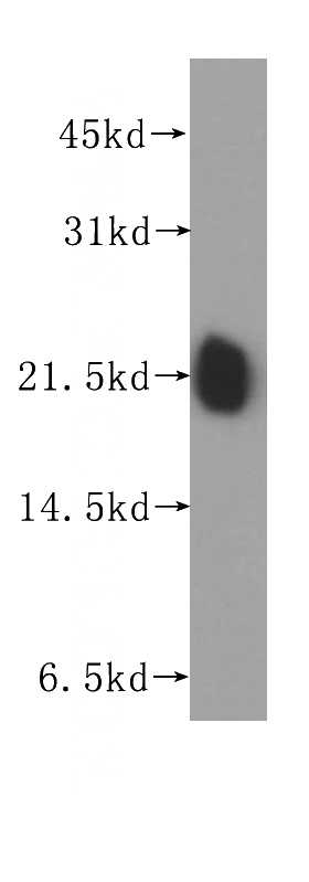 human brain tissue were subjected to SDS PAGE followed by western blot with Catalog No:114657(RHOA antibody) at dilution of 1:400