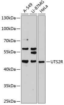 Western blot - UTS2R Polyclonal Antibody 