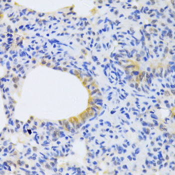 Immunohistochemistry - MRPS30 Polyclonal Antibody 