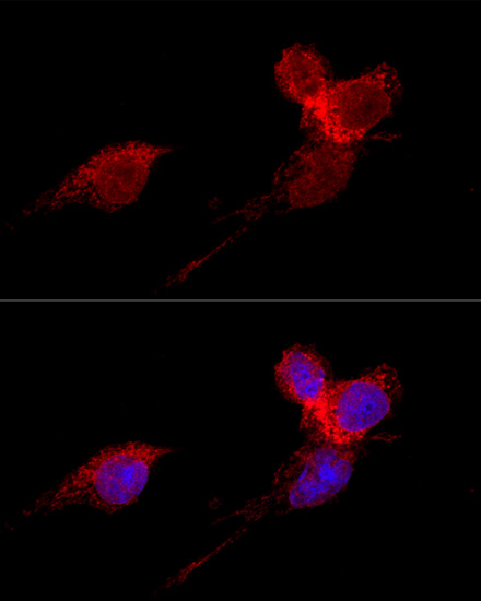 Immunofluorescence - RPL36 Polyclonal Antibody 