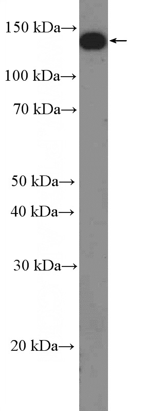 rat brain tissue were subjected to SDS PAGE followed by western blot with Catalog No:113829(PLCB1 Antibody) at dilution of 1:1000