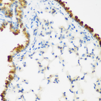 Immunohistochemistry - LRP5 Polyclonal Antibody 