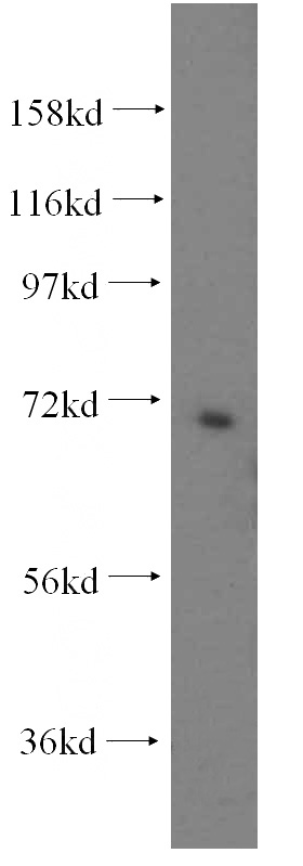 HepG2 cells were subjected to SDS PAGE followed by western blot with Catalog No:113579(PAPSS2 antibody) at dilution of 1:300