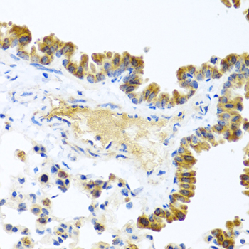 Immunohistochemistry - WNT9A Polyclonal Antibody 