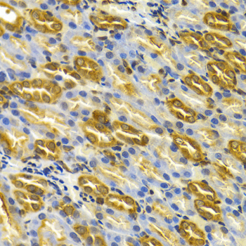 Immunohistochemistry - TCP1 Polyclonal Antibody 