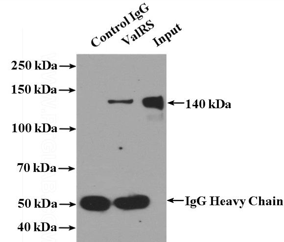 IP Result of anti-VARS (IP:Catalog No:116703, 4ug; Detection:Catalog No:116703 1:500) with HL-60 cells lysate 3040ug.