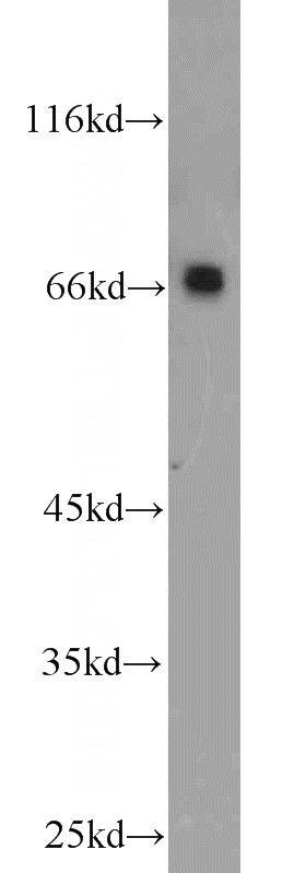 mouse brain tissue were subjected to SDS PAGE followed by western blot with Catalog No:113116(NET1 antibody) at dilution of 1:1000