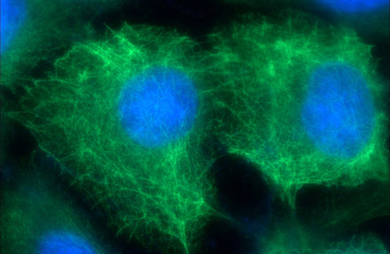 Immunofluorescent analysis of (-20oc Ethanol) fixed A431 cells using Catalog No:109790(KRT13 Antibody) at dilution of 1:50 and Alexa Fluor 488-congugated AffiniPure Goat Anti-Rabbit IgG(H+L)