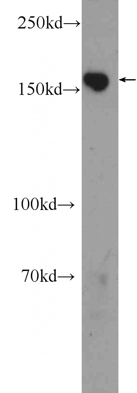 rat brain tissue were subjected to SDS PAGE followed by western blot with Catalog No:109333(CLASP1 Antibody) at dilution of 1:600