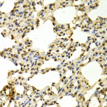 Immunohistochemistry - PADI4 Polyclonal Antibody 