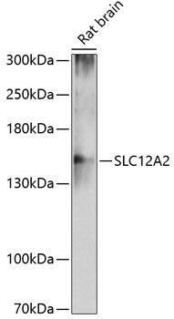 Western blot - SLC12A2 Polyclonal Antibody 