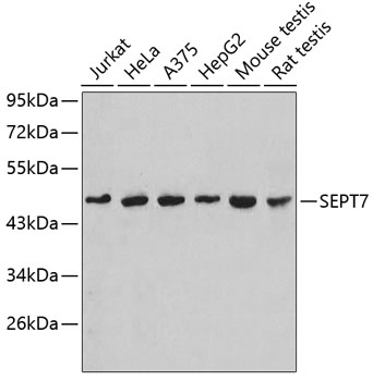 Western blot - SEPT7 Polyclonal Antibody 