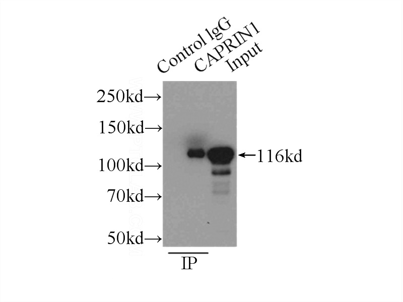IP Result of anti-CAPRIN1 (IP:Catalog No:108839, 3ug; Detection:Catalog No:108839 1:300) with HeLa cells lysate 2500ug.