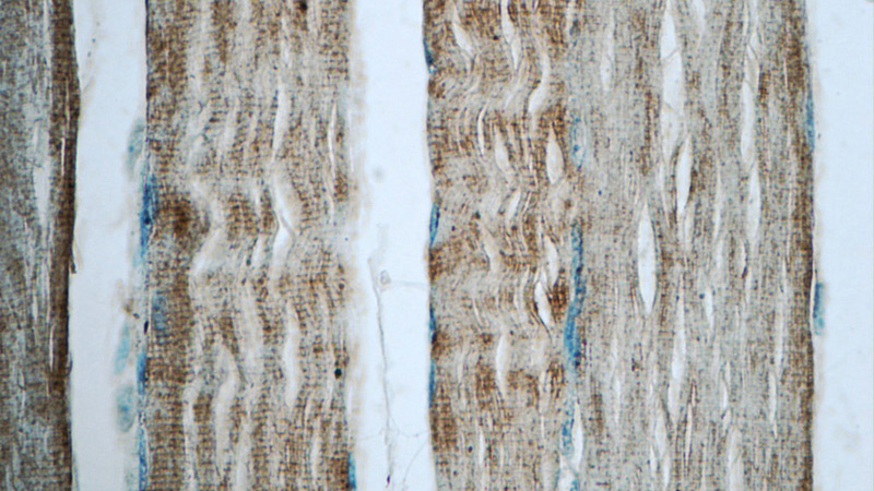 Immunohistochemistry of paraffin-embedded human skeletal muscle tissue slide using Catalog No:116155(TNNT3 Antibody) at dilution of 1:50 (under 40x lens)