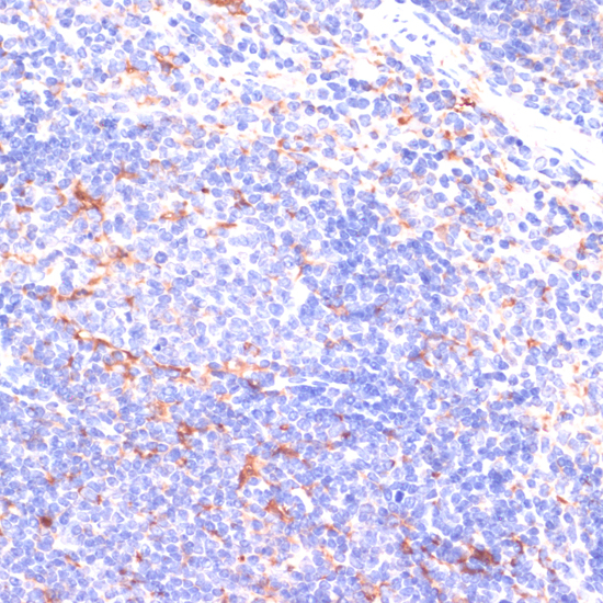 Immunohistochemistry - IKBKE Polyclonal Antibody 