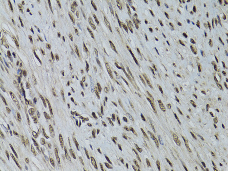 Immunohistochemistry - LKB1 Polyclonal Antibody 