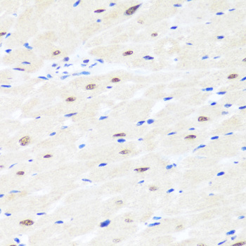 Immunohistochemistry - BRMS1 Polyclonal Antibody 