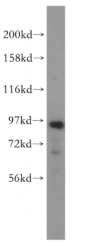 mouse lung tissue were subjected to SDS PAGE followed by western blot with Catalog No:113449(NVL antibody) at dilution of 1:600
