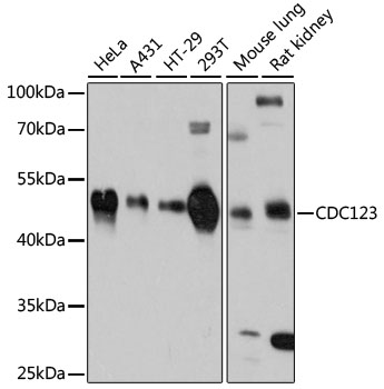 Western blot - CDC123 Polyclonal Antibody 